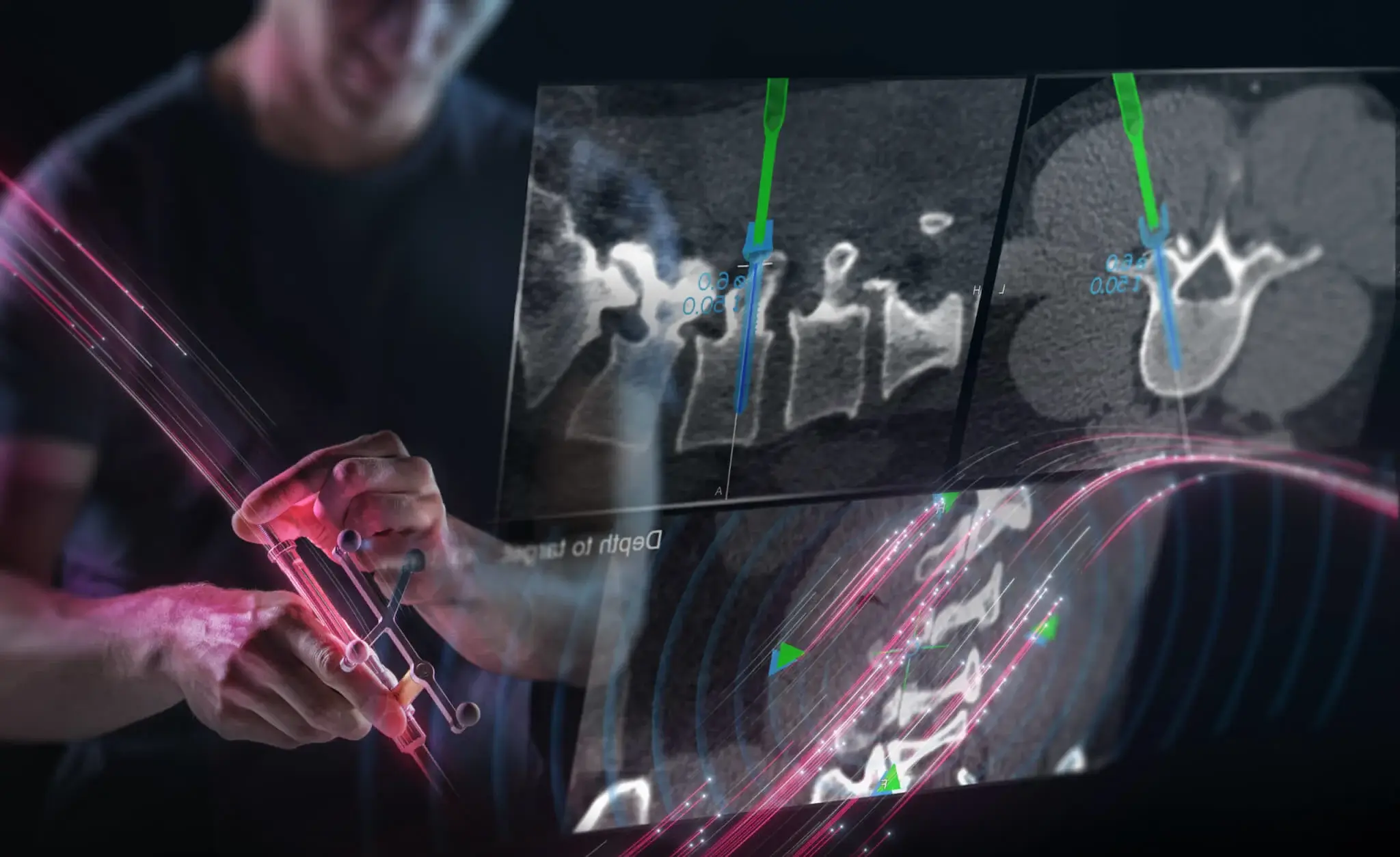Neuronavegación: El GPS del Cerebro y la Columna
